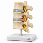 Simulator and Spinal Discopathy
